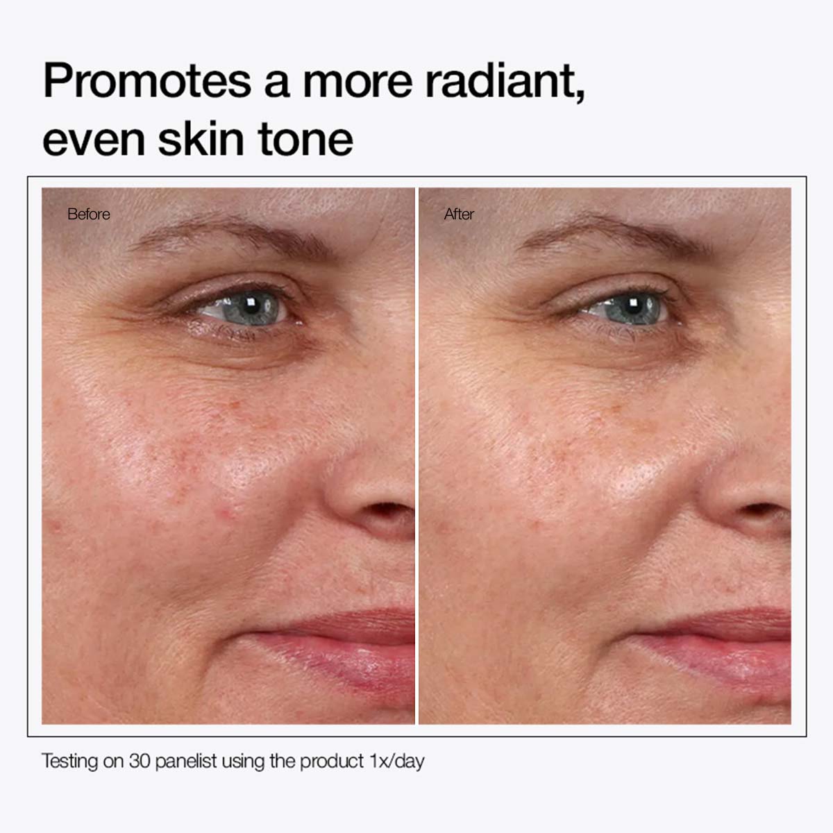 Urapra Glycolic Acid 7% Exfoliating Toner